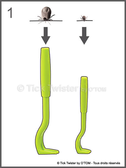 /media/firstaidtips/library/tick-twister-croquis-1.jpg