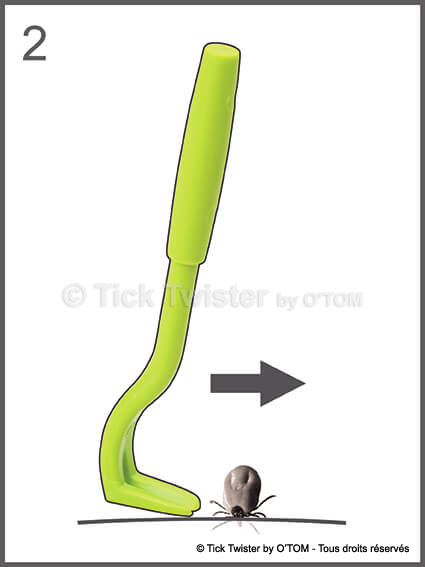 /media/firstaidtips/library/tick-twister-croquis-2.jpg