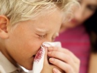 How to treat a nose bleed